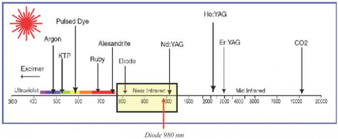 ανώδυνη 30MHZ αφαίρεσης φλεβών αραχνών λέιζερ διόδων 635nm κόκκινη υψηλή συχνότητα μηχανών