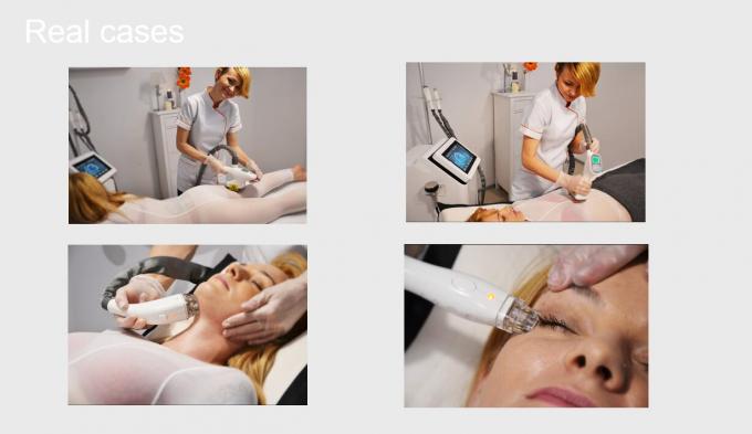 Cavitation+Vacuum+RF+Laser+Roller CE εξοπλισμού ομορφιάς αδυνατίσματος συστημάτων