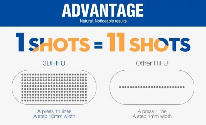 4MHz 11 γραμμές φορητό Hifu επεξεργασία λίφτινγκ Hifu μηχανών/20000 πυροβολισμοί 2$α
